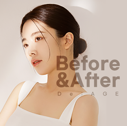 Before & after 배너1